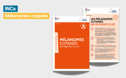 Mélanomes cutanés : l’outil pour la pratique et sa fiche en 10 points clés publié par l’INCa