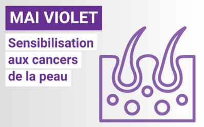#MaiViolet : mois de mobilisation contre les cancers de la peau